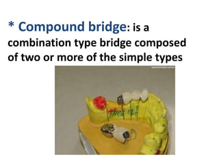 * Compound bridge: is a
combination type bridge composed
of two or more of the simple types
 