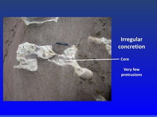 Irregular
concretion
Very few
protrusions
Core
 