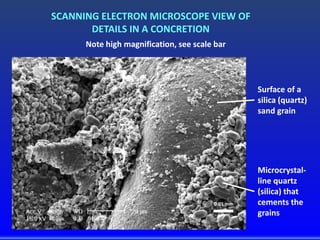 SCANNING ELECTRON MICROSCOPE VIEW OF
DETAILS IN A CONCRETION
Note high magnification, see scale bar
0.01 mm
Surface of a
silica (quartz)
sand grain
Microcrystal-
line quartz
(silica) that
cements the
grains
 