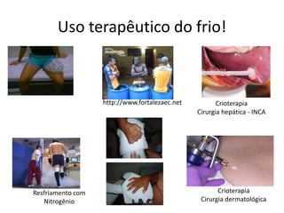 Uso terapêutico do frio!http://www.fortalezaec.netCrioterapia Cirurgia hepática - INCACrioterapia Cirurgia dermatológicaResfriamento com Nitrogênio 