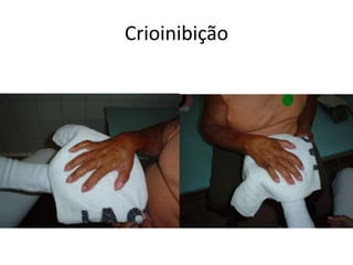Crioinibição