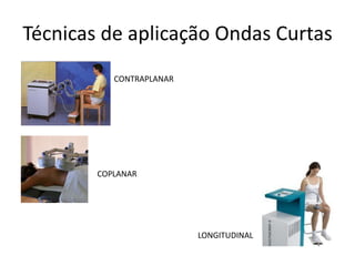 Técnicas de aplicação Ondas CurtasCONTRAPLANARCOPLANARLONGITUDINAL