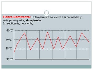 Fiebre Remitente: La temperatura no vuelve a la normalidad y
varia pocos grados, sin apirexia.
Ex: septicemia, neumonía;

40°C

39°C
38°C

37°C

 