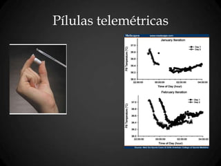 Pílulas telemétricas
 