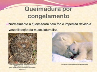 Queimadura por
congelamento
Normalmente a queimadura pelo frio é impedida devido a
vasodilatação da musculatura lisa.
Fonte:http:/dicaspeludas.blogspot.com.br/201
3/07/hipotermia-em-caes-e-
gatos.html#!/2013/07/hipotermia-em-caes-e-
gatos.html
Fonte:http://greenstyle.com.br/tag/urso-polar
 