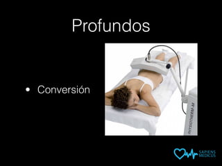 Profundos
• Conversión
 