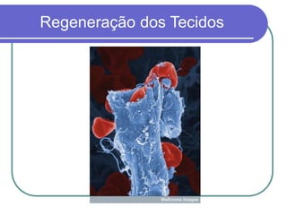 Regeneração dos Tecidos
 