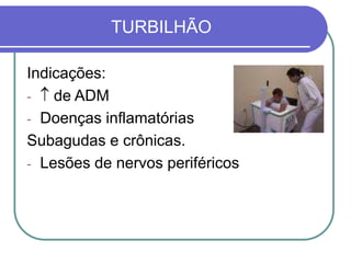 TURBILHÃO
Indicações:
-  de ADM
- Doenças inflamatórias
Subagudas e crônicas.
- Lesões de nervos periféricos
 