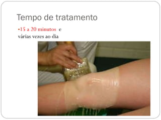 Tempo de tratamento 15 a 20 minutos  e várias vezes ao dia 