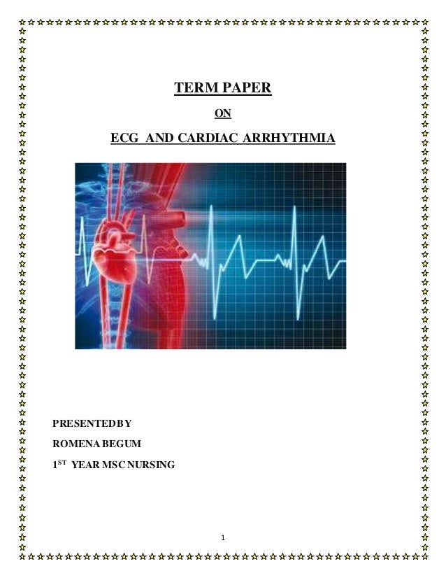 Thesis on arrhythmia 02 image