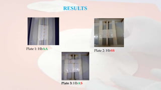 RESULTS
Plate 1: HbAA
Plate 2: HbSS
Plate 3: HbAS
 
