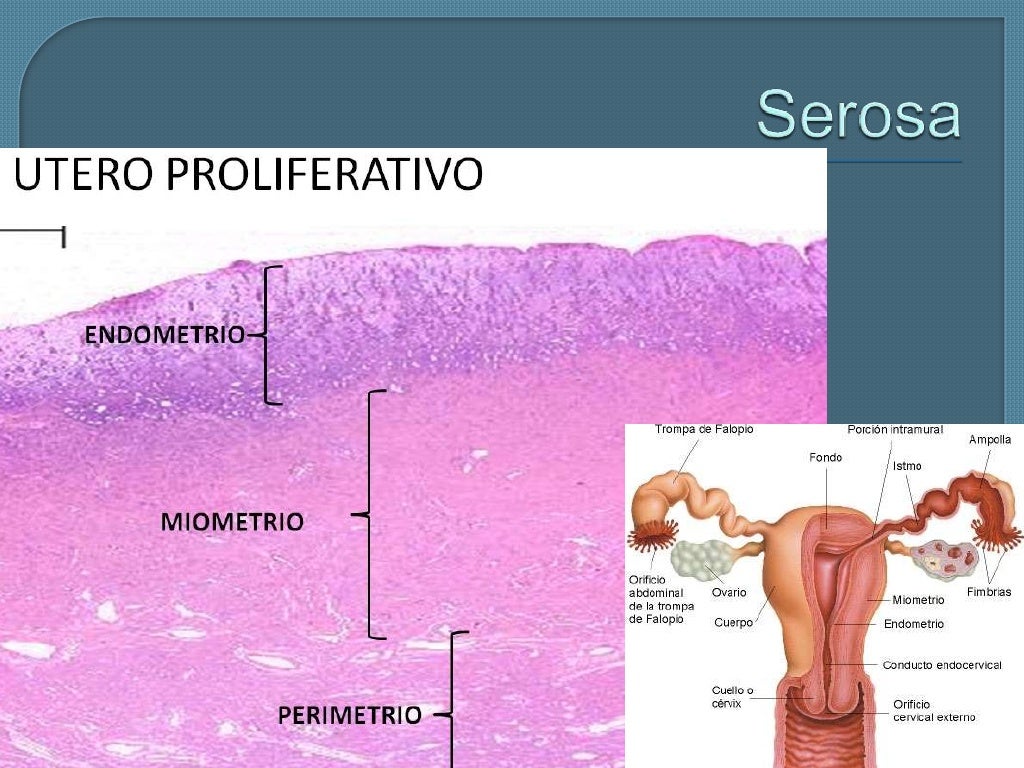 Útero