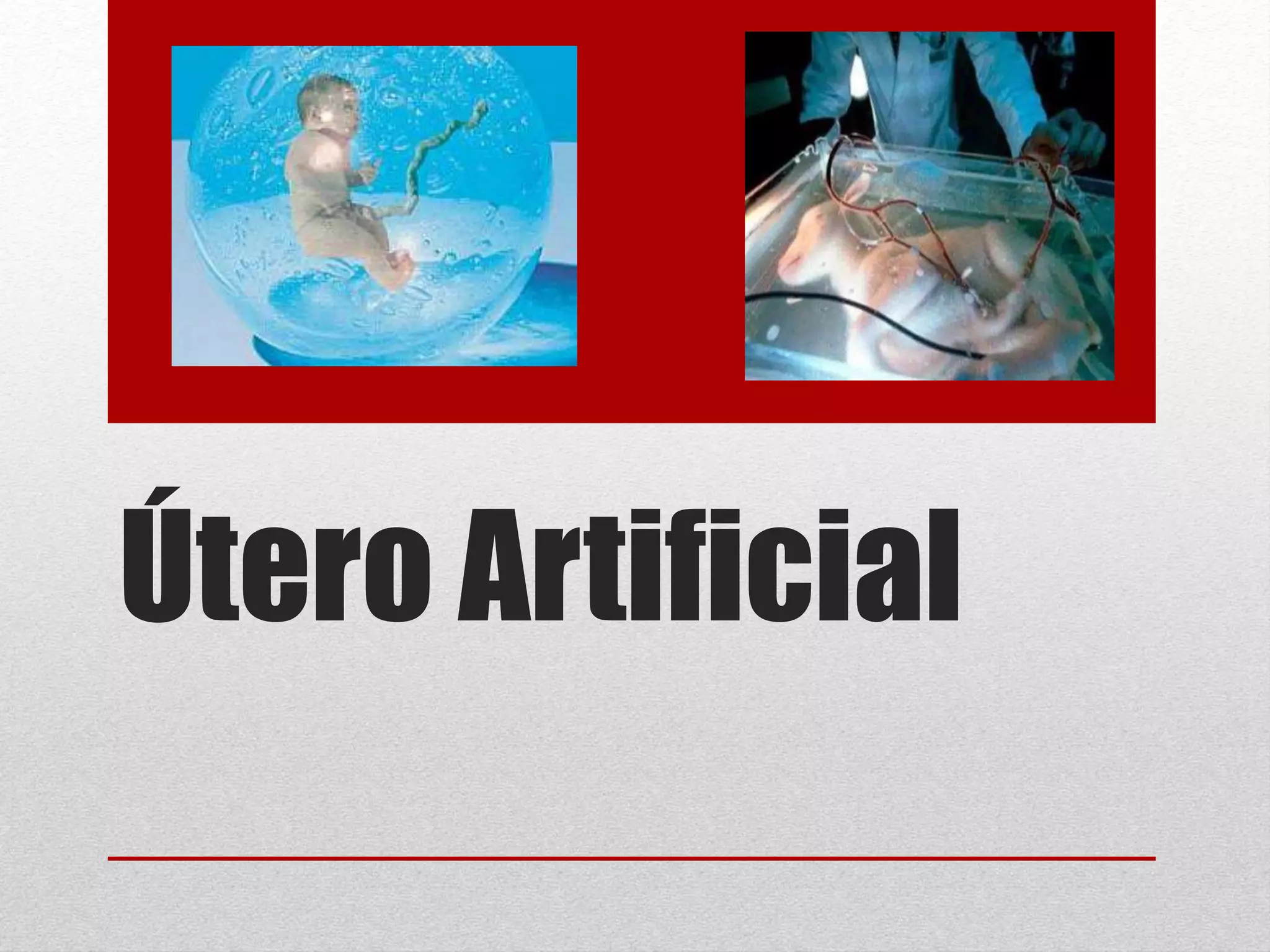 utero artificial PPT