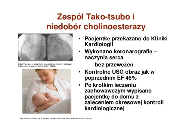 Niedokrwienie serca u ciężarnej