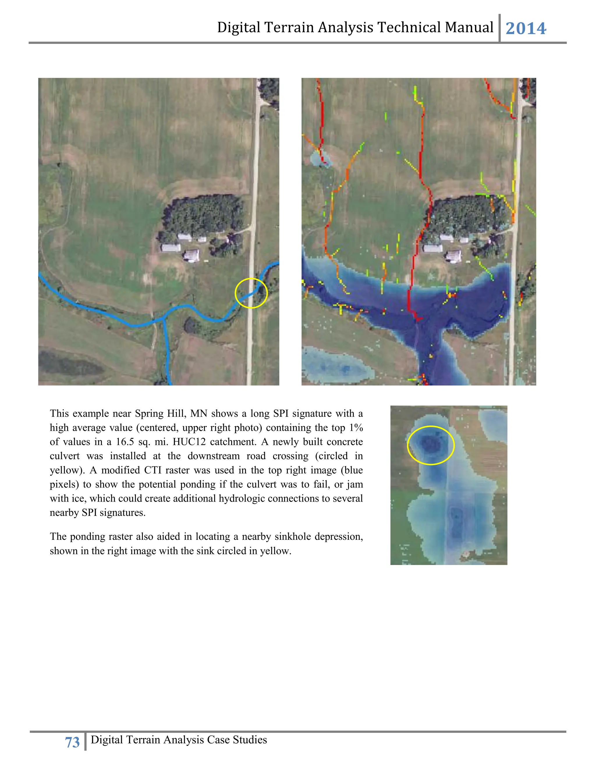 Digital Terrain Analysis Technical Manual 2014
73 Digital Terrain Analysis Case Studies
This example near Spring Hill, MN shows a long SPI signature with a
high average value (centered, upper right photo) containing the top 1%
of values in a 16.5 sq. mi. HUC12 catchment. A newly built concrete
culvert was installed at the downstream road crossing (circled in
yellow). A modified CTI raster was used in the top right image (blue
pixels) to show the potential ponding if the culvert was to fail, or jam
with ice, which could create additional hydrologic connections to several
nearby SPI signatures.
The ponding raster also aided in locating a nearby sinkhole depression,
shown in the right image with the sink circled in yellow.
 