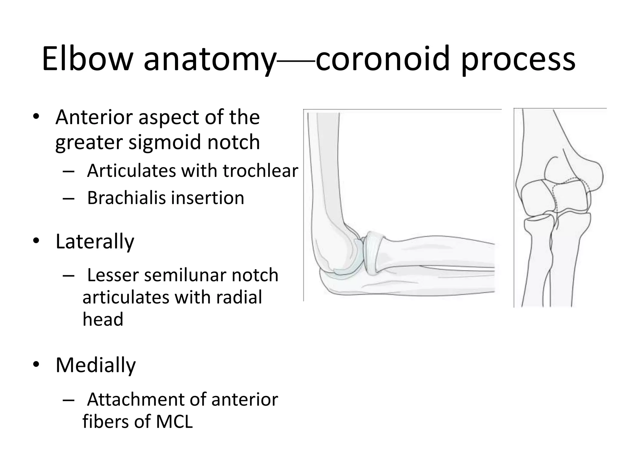 Terrible triad - elbow | PPTX