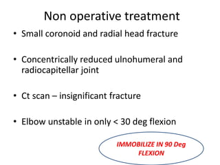 Non operative treatment
• Small coronoid and radial head fracture
• Concentrically reduced ulnohumeral and
radiocapitellar joint
• Ct scan – insignificant fracture
• Elbow unstable in only < 30 deg flexion
IMMOBILIZE IN 90 Deg
FLEXION
 