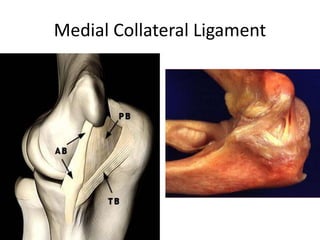 Medial Collateral Ligament
 