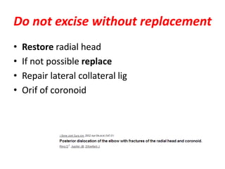 Do not excise without replacement
• Restore radial head
• If not possible replace
• Repair lateral collateral lig
• Orif of coronoid
 