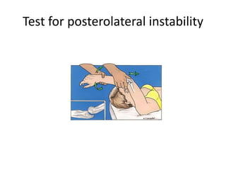 Test for posterolateral instability
 