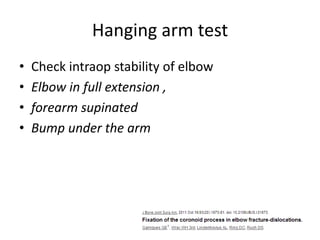 Hanging arm test
• Check intraop stability of elbow
• Elbow in full extension ,
• forearm supinated
• Bump under the arm
 