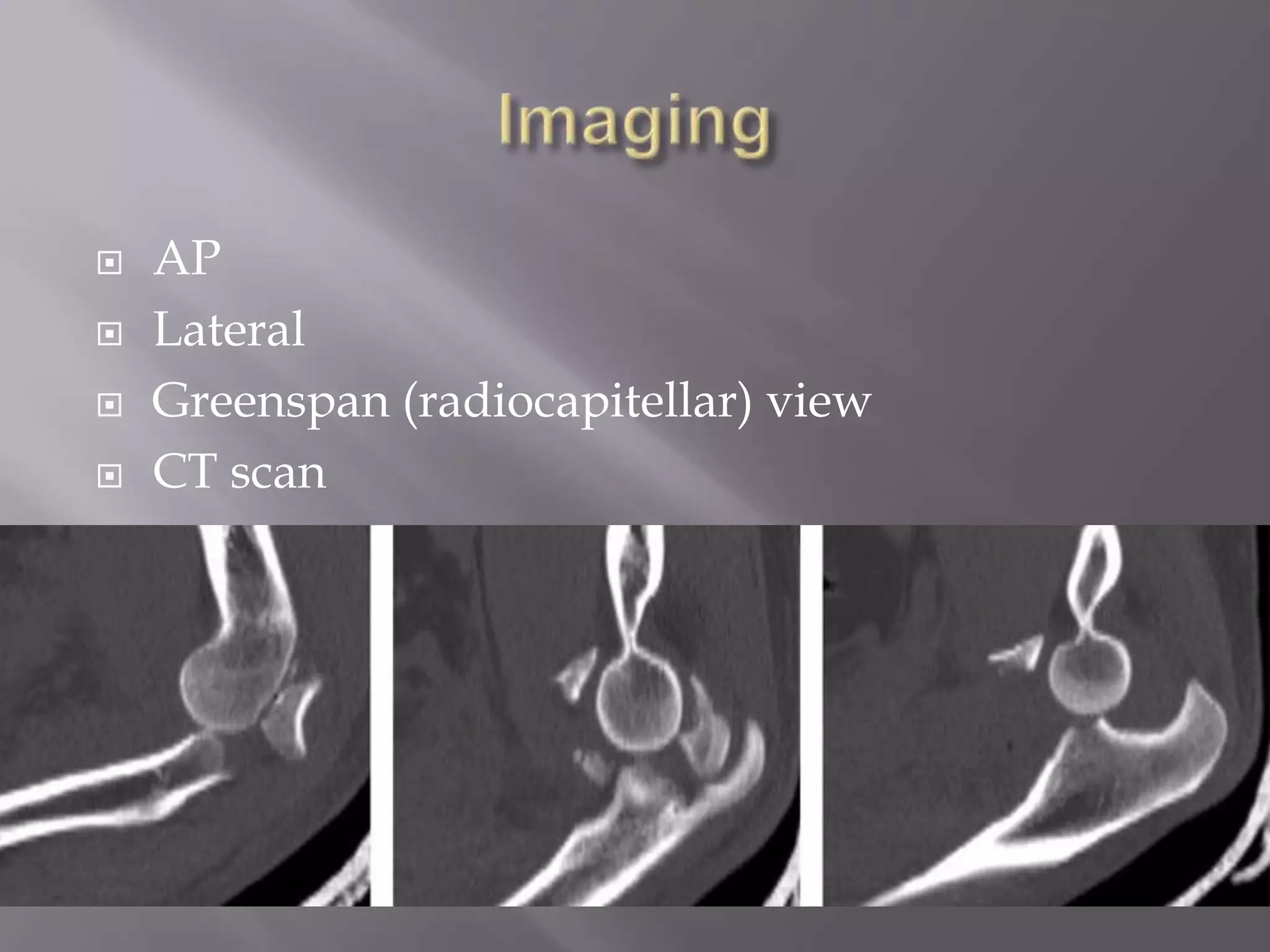  AP
Lateral
Greenspan (radiocapitellar) view
CT scan
