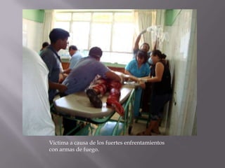 Victima a causa de los fuertes enfrentamientos
con armas de fuego.
 