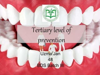 Tertiary level of
prevention
Uzma Jan
48
BDS Batch III
 