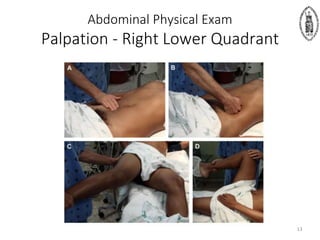 Abdominal Physical Exam
Palpation - Right Lower Quadrant
13
 