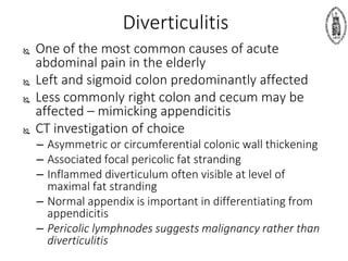 Diverticulitis
 One of the most common causes of acute
abdominal pain in the elderly
 Left and sigmoid colon predominantly affected
 Less commonly right colon and cecum may be
affected – mimicking appendicitis
 CT investigation of choice
– Asymmetric or circumferential colonic wall thickening
– Associated focal pericolic fat stranding
– Inflammed diverticulum often visible at level of
maximal fat stranding
– Normal appendix is important in differentiating from
appendicitis
– Pericolic lymphnodes suggests malignancy rather than
diverticulitis
 