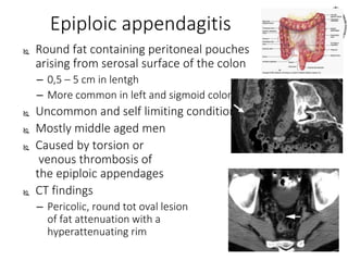 Epiploic appendagitis
 Round fat containing peritoneal pouches
arising from serosal surface of the colon
– 0,5 – 5 cm in lentgh
– More common in left and sigmoid colon
 Uncommon and self limiting condition
 Mostly middle aged men
 Caused by torsion or
venous thrombosis of
the epiploic appendages
 CT findings
– Pericolic, round tot oval lesion
of fat attenuation with a
hyperattenuating rim
 