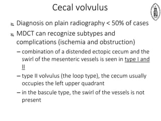 Cecal volvulus
 Diagnosis on plain radiography < 50% of cases
 MDCT can recognize subtypes and
complications (ischemia and obstruction)
– combination of a distended ectopic cecum and the
swirl of the mesenteric vessels is seen in type I and
II
– type II volvulus (the loop type), the cecum usually
occupies the left upper quadrant
– in the bascule type, the swirl of the vessels is not
present
 