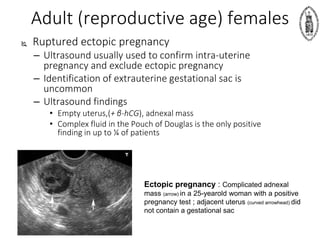 Adult (reproductive age) females
 Ruptured ectopic pregnancy
– Ultrasound usually used to confirm intra-uterine
pregnancy and exclude ectopic pregnancy
– Identification of extrauterine gestational sac is
uncommon
– Ultrasound findings
• Empty uterus,(+ β-hCG), adnexal mass
• Complex fluid in the Pouch of Douglas is the only positive
finding in up to ¼ of patients
Ectopic pregnancy : Complicated adnexal
mass (arrow) in a 25-yearold woman with a positive
pregnancy test ; adjacent uterus (curved arrowhead) did
not contain a gestational sac
 