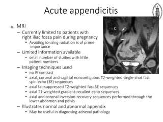 Acute appendicitis
 MRI
– Currently limited to patients with
right iliac fossa pain during pregnancy
• Avoiding ionizing radiation is of prime
importance
– Limited information available
• small number of studies with little
patient numbers
– Imaging techniques used
• no IV contrast
• axial, coronal and sagittal noncontiguous T2-weighted single-shot fast
spin-echo (SE) sequences
• axial fat-suppressed T2-weighted fast SE sequences
• axial T1-weighted gradient-recalled-echo sequences
• axial and coronal inversion-recovery sequences performed through the
lower abdomen and pelvis
– Illustrates normal and abnormal appendix
• May be useful in diagnosing adnexal pathology
 