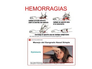 HEMORRAGIAS
http://image.slidesharecdn.com/captulo-14-hemorragia-y-estado-de-shock-1200558659912310-
2/95/captulo-14-hemorragia-y-estado-de-shock-31-728.jpg?cb=1200551461
http://www.estrucplan.com.ar/contenidos/shml/PAuxilios/image003.gif
 