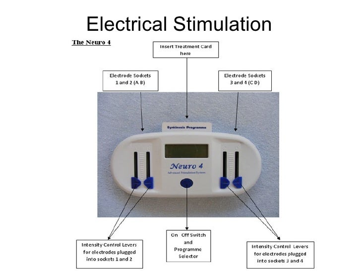 Bell's Palsy Electrical Stimulation Treatment