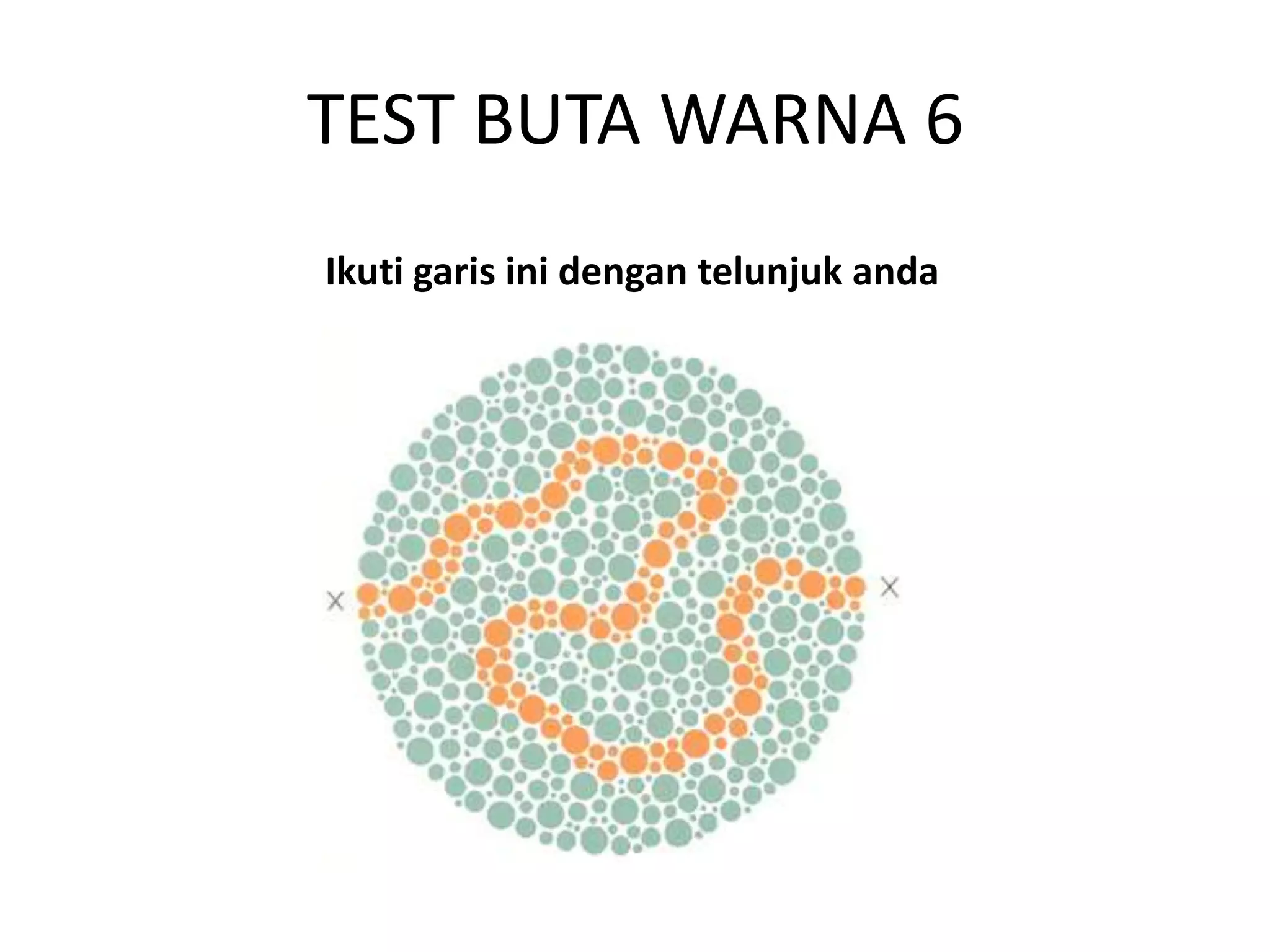 TEST BUTA WARNA 6
Ikuti garis ini dengan telunjuk anda
