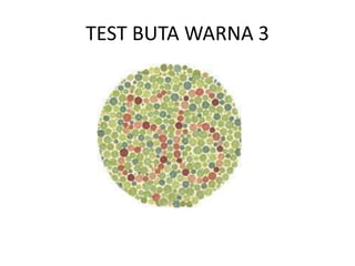 Tes buta warna 1 | PPTX