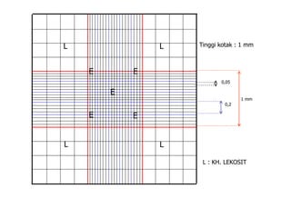 0,2
0,05
1 mm
Tinggi kotak : 1 mm
L : KH. LEKOSIT
EE
E
E E
L
L L
L
 