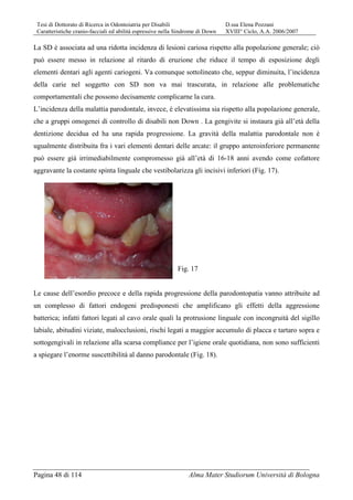 Tesi di Dottorato di Ricerca in Odontoiatria per Disabili D.ssa Elena Pozzani
Caratteristiche cranio-facciali ed abilità espressive nella Sindrome di Down XVIII° Ciclo, A.A. 2006/2007
Pagina 48 di 114 Alma Mater Studiorum Università di Bologna
La SD è associata ad una ridotta incidenza di lesioni cariosa rispetto alla popolazione generale; ciò
può essere messo in relazione al ritardo di eruzione che riduce il tempo di esposizione degli
elementi dentari agli agenti cariogeni. Va comunque sottolineato che, seppur diminuita, l’incidenza
della carie nel soggetto con SD non va mai trascurata, in relazione alle problematiche
comportamentali che possono decisamente complicarne la cura.
L’incidenza della malattia parodontale, invece, è elevatissima sia rispetto alla popolazione generale,
che a gruppi omogenei di controllo di disabili non Down . La gengivite si instaura già all’età della
dentizione decidua ed ha una rapida progressione. La gravità della malattia parodontale non è
ugualmente distribuita fra i vari elementi dentari delle arcate: il gruppo anteroinferiore permanente
può essere già irrimediabilmente compromesso già all’età di 16-18 anni avendo come cofattore
aggravante la costante spinta linguale che vestibolarizza gli incisivi inferiori (Fig. 17).
Fig. 17
Le cause dell’esordio precoce e della rapida progressione della parodontopatia vanno attribuite ad
un complesso di fattori endogeni predisponesti che amplificano gli effetti della aggressione
batterica; infatti fattori legati al cavo orale quali la protrusione linguale con incongruità del sigillo
labiale, abitudini viziate, malocclusioni, rischi legati a maggior accumulo di placca e tartaro sopra e
sottogengivali in relazione alla scarsa compliance per l’igiene orale quotidiana, non sono sufficienti
a spiegare l’enorme suscettibilità al danno parodontale (Fig. 18).
 