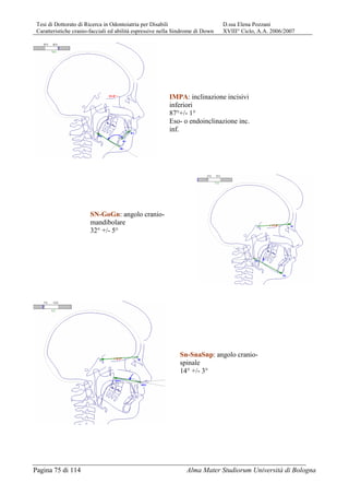 Tesi di Dottorato di Ricerca in Odontoiatria per Disabili D.ssa Elena Pozzani
Caratteristiche cranio-facciali ed abilità espressive nella Sindrome di Down XVIII° Ciclo, A.A. 2006/2007
Pagina 75 di 114 Alma Mater Studiorum Università di Bologna
IMPA: inclinazione incisivi
inferiori
87°+/- 1°
Eso- o endoinclinazione inc.
inf.
SN-GoGn: angolo cranio-
mandibolare
32° +/- 5°
Sn-SnaSnp: angolo cranio-
spinale
14° +/- 3°
 