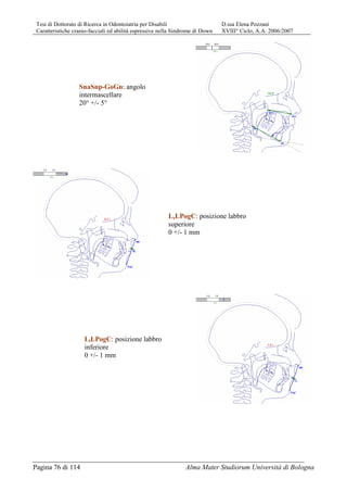 Tesi di Dottorato di Ricerca in Odontoiatria per Disabili D.ssa Elena Pozzani
Caratteristiche cranio-facciali ed abilità espressive nella Sindrome di Down XVIII° Ciclo, A.A. 2006/2007
Pagina 76 di 114 Alma Mater Studiorum Università di Bologna
SnaSnp-GoGn: angolo
intermascellare
20° +/- 5°
LsLPogC: posizione labbro
superiore
0 +/- 1 mm
LiLPogC: posizione labbro
inferiore
0 +/- 1 mm
 