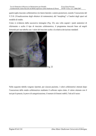 Tesi di Dottorato di Ricerca in Odontoiatria per Disabili D.ssa Elena Pozzani
Caratteristiche cranio-facciali ed abilità espressive nella Sindrome di Down XVIII° Ciclo, A.A. 2006/2007
Pagina 83 di 114 Alma Mater Studiorum Università di Bologna
qualsivoglia tracciato cefalometrico (in latero-laterale o antero-posteriore), nonche l’esecuzione del
V.T.O. (Visualizzazione degli obiettevi di trattamento), del “morphing” e l’analisi degli spazi sul
modello di studio.
Come si evidenzia dalla successiva immagine (Fig. 22), una volta segnati i punti anatomici di
riferimento e scelto il tipo di tracciato cefalometrico, il programma traccerà linee ed angoli
fornendo poi una tabella con i valori del tracciato scelto e la relativa deviazione standard:
Fig. 22
Nella seguente tabella vengono riportati, per ciascun paziente, i valori cefalometrici ottenuti dopo
l’esecuzione dello studio cefalometrico mediante il software sopra citato, il valore ottenuto con il
test per le prassie, le prove di categorizzazione, il numero di fonemi stabili, l’età ed il sesso:
 
