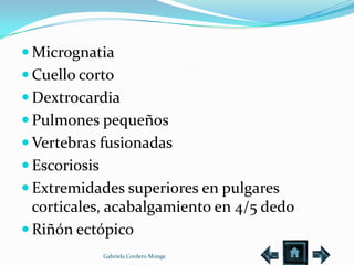  Micrognatia
 Cuello corto
 Dextrocardia
 Pulmones pequeños
 Vertebras fusionadas
 Escoriosis
 Extremidades superiores en pulgares
  corticales, acabalgamiento en 4/5 dedo
 Riñón ectópico
               Gabriela Cordero Monge
 