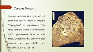 Comprehensive Oral Presentation on Necrosis: Causes, Types, and ...
