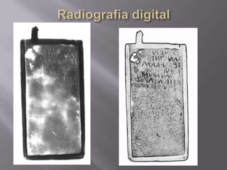 Radiografia digital
