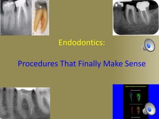 Endodontics:
Procedures That Finally Make Sense
 