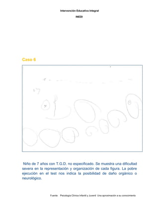 Test bender sustento practico