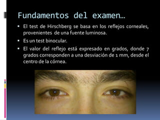 Fundamentos del examen…
 El test de Hirschberg se basa en los reflejos corneales,
provenientes de una fuente luminosa.
 Es un test binocular.
 El valor del reflejo está expresado en grados, donde 7
grados corresponden a una desviación de 1 mm, desde el
centro de la córnea.
 