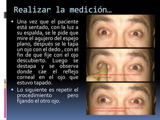 Realizar la medición…
 Una vez que el paciente
está sentado, con la luz a
su espalda, se le pide que
mire el agujero del espejo
plano, después se le tapa
un ojo con el dedo , con el
fin de que fije con el ojo
descubierto. Luego se
destapa y se observa
donde cae el reflejo
corneal en el ojo que
estuvo tapado.
 Lo siguiente es repetir el
procedimiento pero
fijando el otro ojo.
 